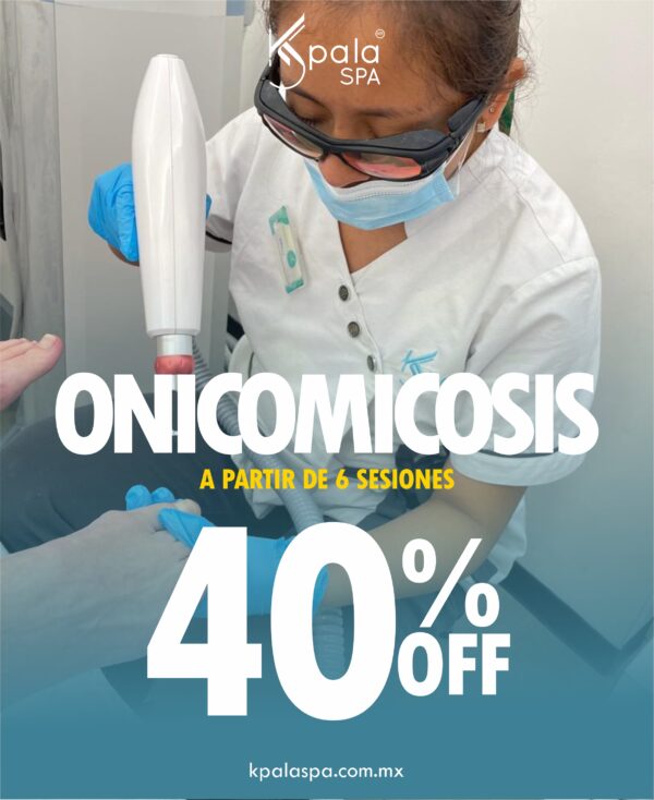 Onicomicosis