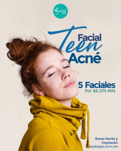Control acné Acné