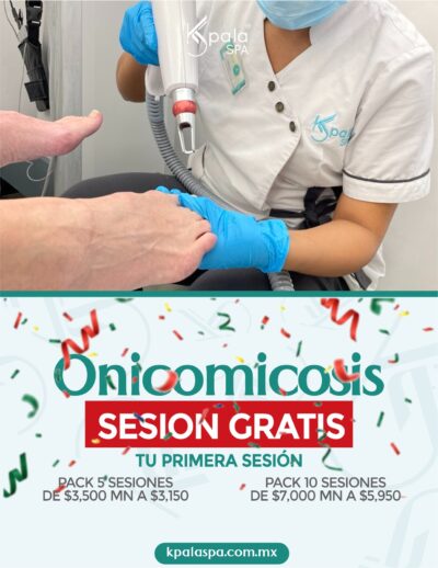 onicomicosis